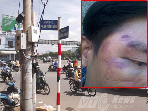 Vết thương của anh Sỹ