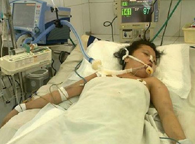 Sản phụ Thảo được theo dõi và điều trị tại Bệnh viện đa khoa Đà Nẵng