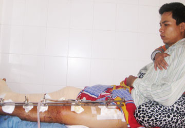 Nạn nhân bị công an bắn 7 phát vào chân