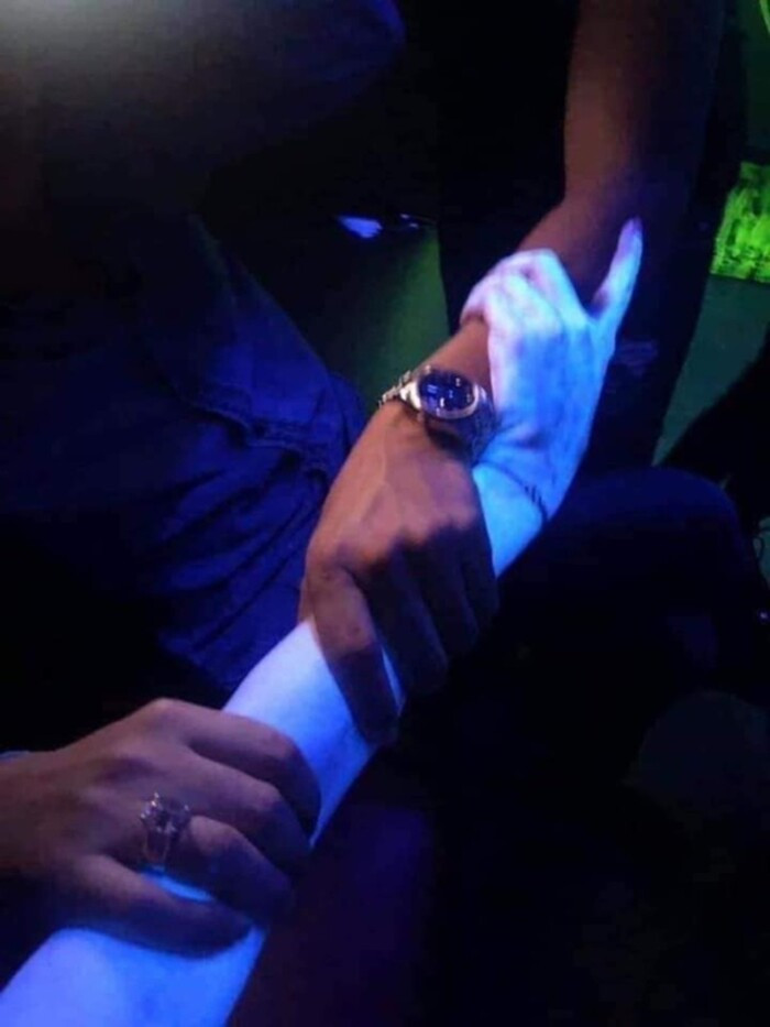 Đi pub cùng với hội bạn, tay chân cô gái bỗng phát sáng như zoombie - Hình 2 Di pub cung voi hoi ban, tay chan co gai bong phat sang nhu zoombie-Hinh-2