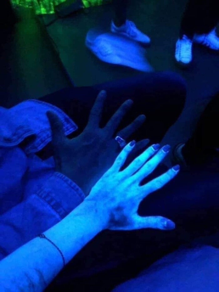 Đi pub cùng với hội bạn, tay chân cô gái bỗng phát sáng như zoombie Di pub cung voi hoi ban, tay chan co gai bong phat sang nhu zoombie