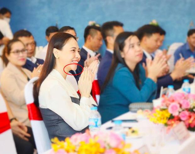 ô từng dính nghi vấn tiêm cằm với chiếc cằm Vline, nhọn hoắt.