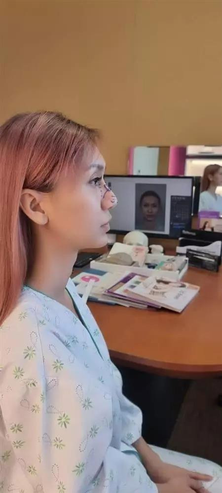 ù đã sở hữu nhan sắc khá nuột nà chuẩn con gái nhưng Lynk Lee vẫn quyết tâm chỉnh sửa thêm các đường nét trên gương mặt để hoàn hảo hơn.