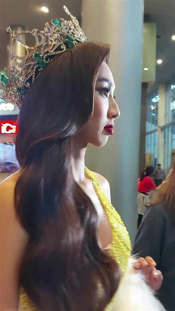 ên dưới bài đăng của Hoa hậu Thùy Tiên, bên cạnh một bộ phận khán giả khuyên cô đi tấu hài sau khi kết thúc nhiệm kỳ, rất nhiều người nhanh tay chia sẻ khoảnh khắc bắt gặp cục mụn của Thùy Tiên.