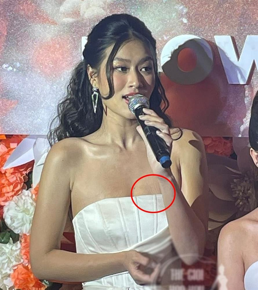 ong cũng nhờ những hình ảnh chưa qua chỉnh sửa dân tình nhận ra người đẹp để lộ vết rạn ngay vùng ngực. Đây là hệ quả của việc giảm nhanh 15kg để thi Miss Grand Vietnam của cô nàng.