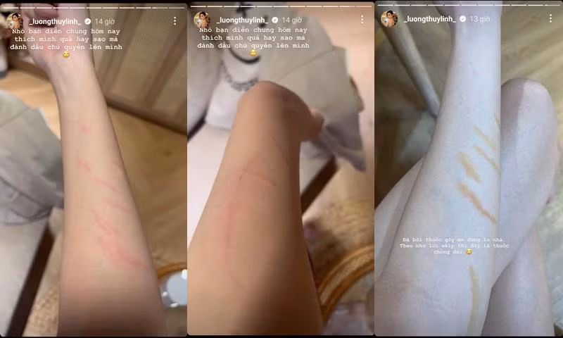 Lương Thùy Linh dù không bị mèo chạy khỏi tay như Đỗ Thị Hà nhưng cũng gặp rất nhiều vết trầy. Hiện tại, Đỗ Thị Hà đang trong những ngày cuối cùng của nhiệm kỳ Hoa hậu Việt Nam 2020. Cô sẽ trao vương miện cho Hoa hậu Việt Nam 2022, lộ diện vào ngày 23/12 tới đây.