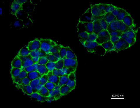 Khối u ác tính 3D là tiến bộ y học vượt trội nhất.
