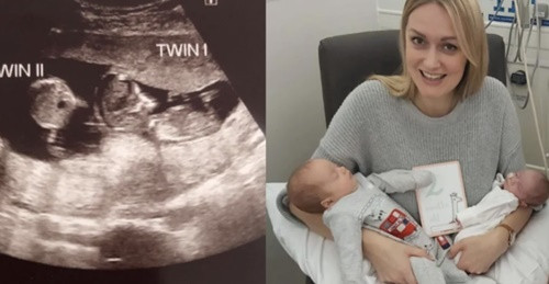 Kỳ lạ bé gái bất ngờ có bạn “chung nhà” sau 3 tháng mẹ mang bầu ảnh 1