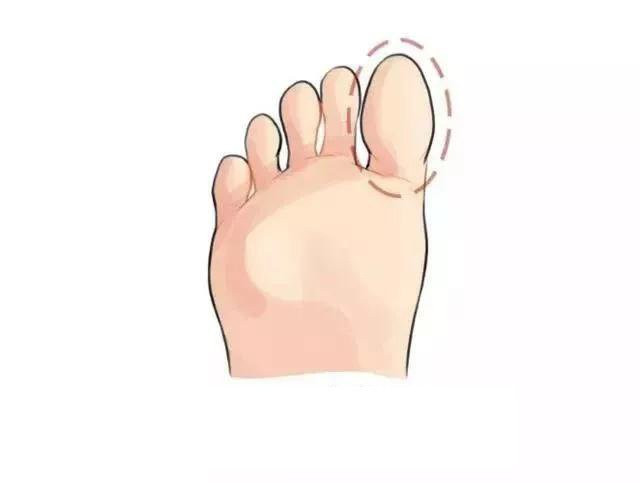 Nhìn tướng bàn chân biết ngay hậu vận sang hay hèn - Hình 3 Nhin tuong ban chan biet ngay hau van sang hay hen-Hinh-3