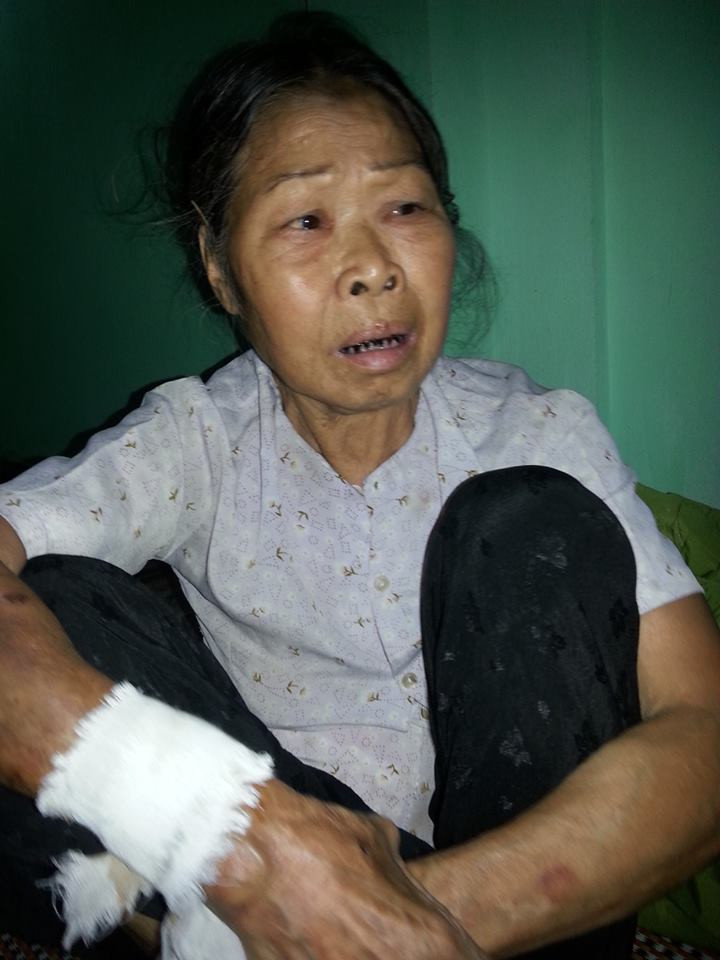 Bà Dương Thị Mùi đau đớn khi kể lại giây phút chứng kiến cảnh tượng kinh hoàng trong đêm định mệnh ấy.