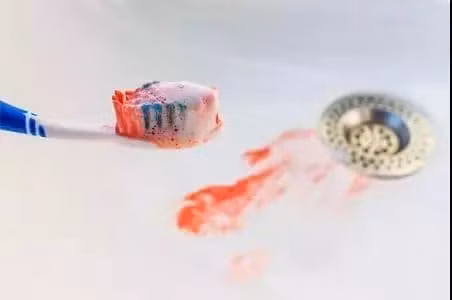 Ban chai danh rang dung bao lau thi nen thay?-Hinh-6