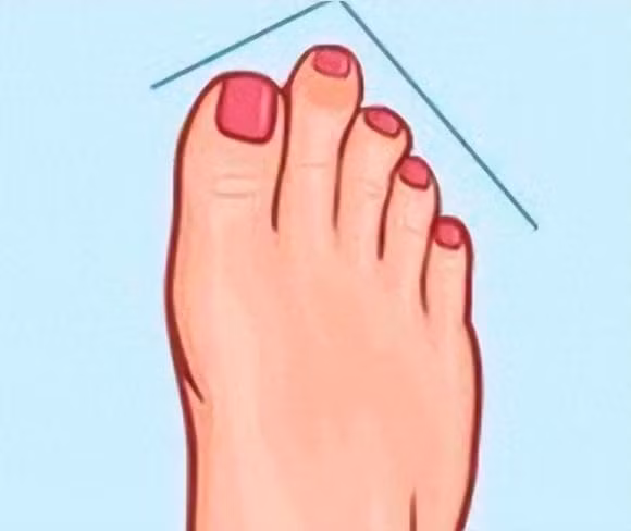 Trac nghiem tam ly: Ban chan cua ban co hinh dang nao sau day?-Hinh-2