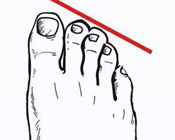 Trac nghiem tam ly: Ban chan cua ban co hinh dang nao sau day?-Hinh-4