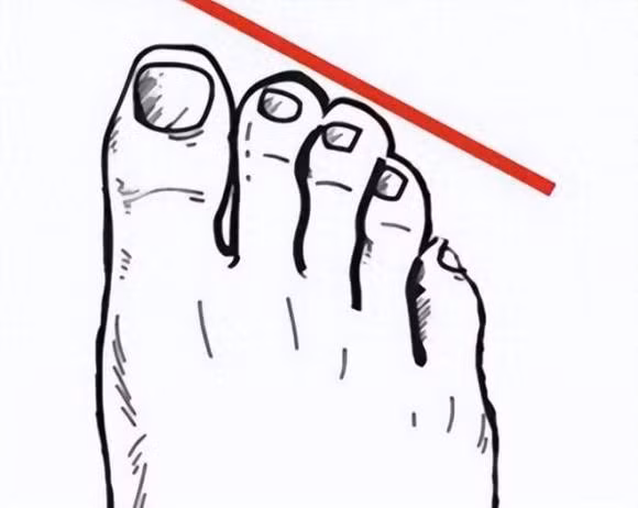 Trac nghiem tam ly: Ban chan cua ban co hinh dang nao sau day?-Hinh-4