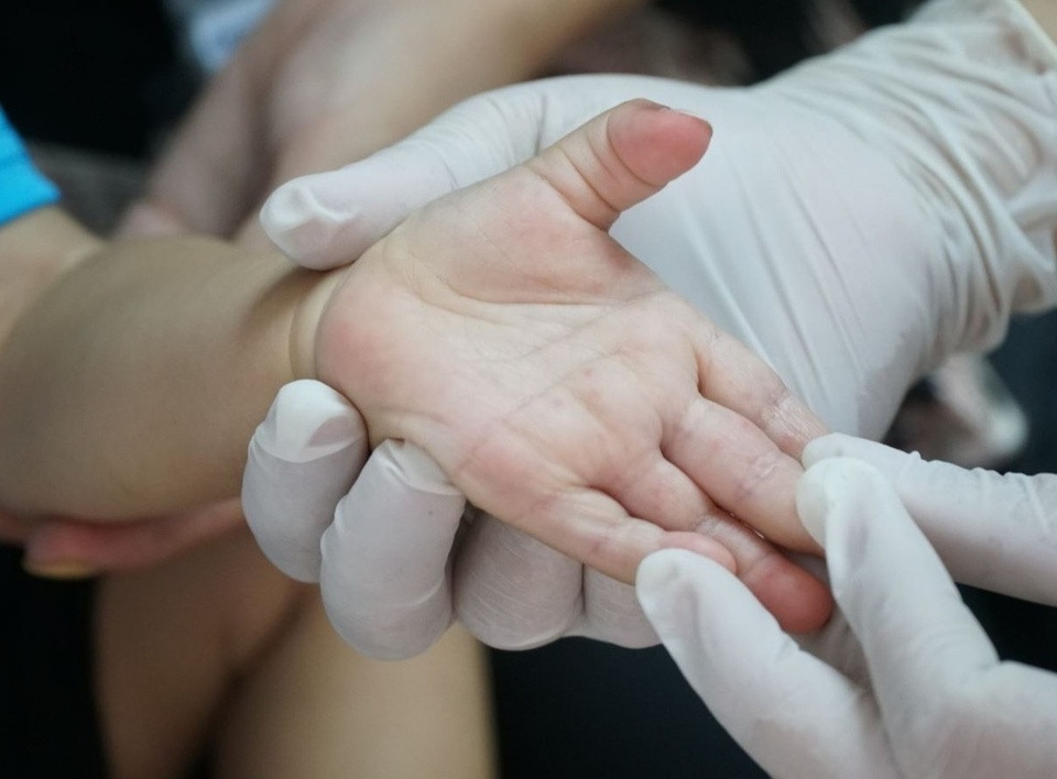 Be trai tu vong sau 4 ngay co bieu hien benh tay chan mieng