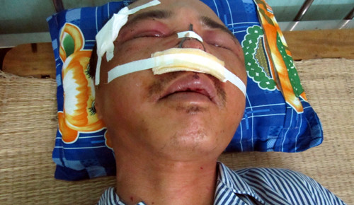 Anh Xuân bị nhóm côn đồ đánh