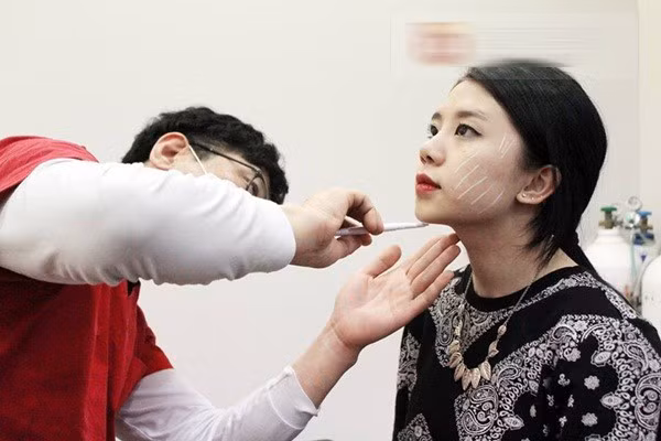 Sau khi dùng cồn y tế sát trùng, bác sĩ xuyên mũi tiêm vào sâu trong da rồi vừa rút ống tiêm vừa bơm thuốc. Quá trình tiêm diễn ra khá nhanh gọn, chỉ trong khoảng 5 phút.