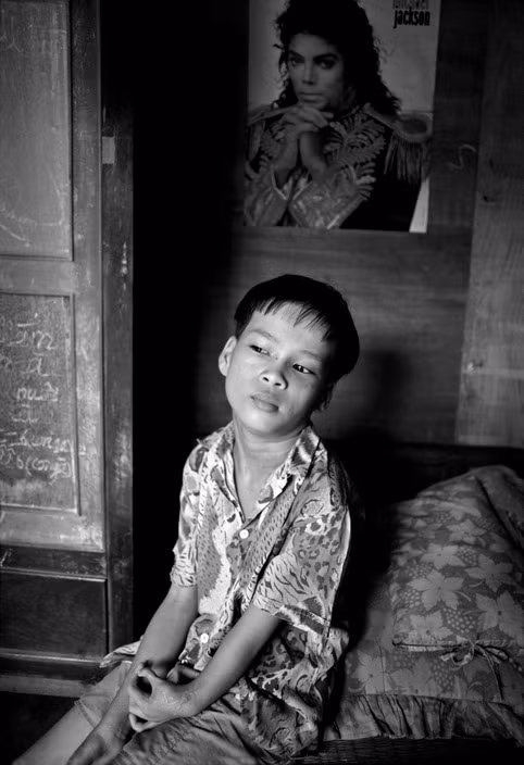 Em Võ Trọng Thủy, 13 tuổi, sống trong một cái chòi bằng gỗ và rơm rạ trong một ngôi chùa ở Sông Bé. Thủy ra đời với dị tật ở tay và không thể vận động như những đứa trẻ bình thường. Sau nhiều lần phẫu thuật ở Đức, cánh tay em đã dần được phục hồi chức năng. Khu vực em sống không bị rải trực tiếp chất độc da cam, nhưng gia đình em lấy nước uống từ con kênh dẫn nước từ một con sông bị ô nhiễm dioxin gần đó, 1994. Ảnh: Philip Jones Griffiths - Magnumphotos.com