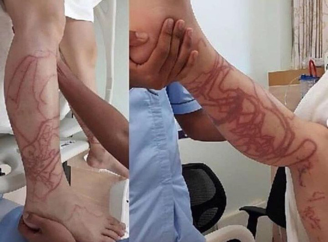 Di bien gap sinh vat nay can tranh ngay-Hinh-2