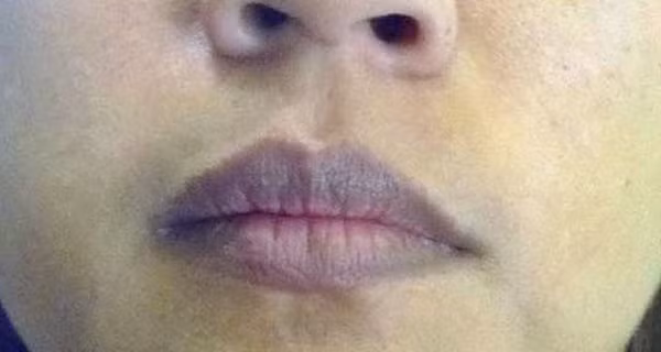 3 vung tren co the phu nu sam mau chung to tu cung rat ban