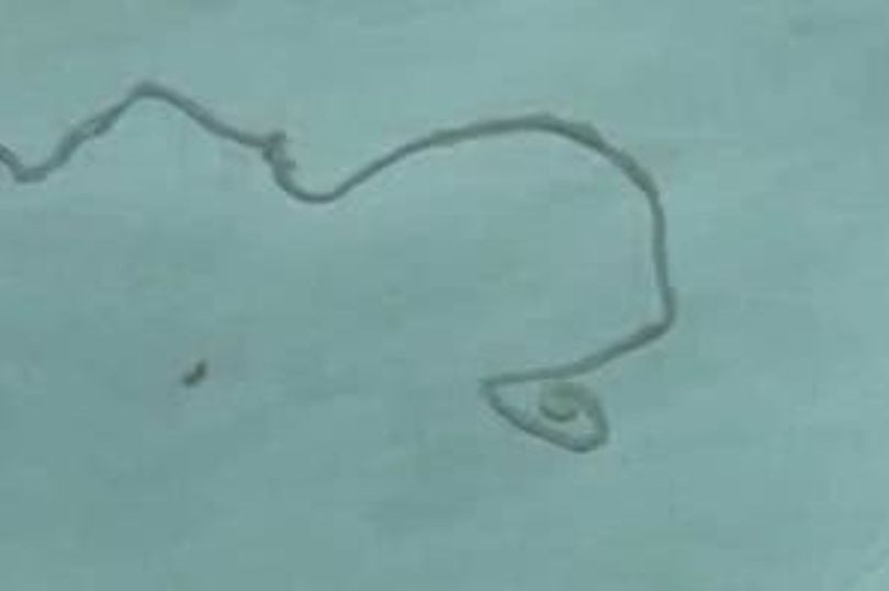 Thay dau dau, ghe ron phat hien con vat dai 12cm song trong nao