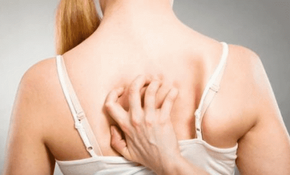 'Ngua' 2 bo phan tren co the, dung nham la di ung-Hinh-4