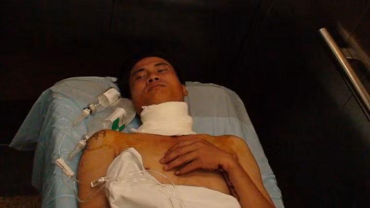 Trong lúc 2 anh Hồ Đức Nhuần (ảnh anh Nhuần thời điểm cấp cứu tại bệnh viện) và Phan Văn Phúc đứng đón con trước cổng trường thị bị đối tượng Nguyễn Văn T. (33 tuổi, ngụ quận Bình Tân) trong cơn ảo giác ma túy đã dùng dao thái lan tấn công cắt cổ khiến 2 vị phụ huynh này phải nhập viện cấp cứu. Sau khi gây án, hung thủ đã bị bắt giữ và được đưa vào bệnh viện tâm thần điều trị.