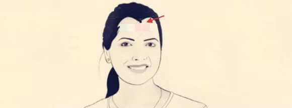 Tren mat co 4 not ruoi tai hoa vat va ca doi-Hinh-4