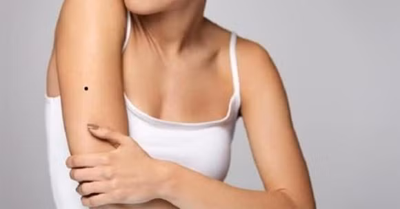  Nốt ruồi sau cánh tay (trai tay trái, gái tay phải): Nếu phía sau cánh tay phải của người phụ nữ hoặc sau cánh tay trái của người đàn ông có nốt ruồi thì thường lâm vào cảnh cô quạnh, hôn nhân và chuyện tình cảm gặp nhiều trắc trở, thậm chí mối quan hệ với người thân cũng không được tốt, hậu vận sẽ sống trong sự cô đơn. (*)Thông tin trong bài mang tính tham khảo, chiêm nghiệm.