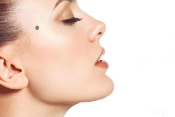  Nốt ruồi ở hai bên trán, gần chân tóc, ngang với vị trí lông mày: Những người này phải đặc biệt chú ý an toàn khi đi ra ngoài, có nguy cơ gặp phải nguy hiểm, dễ gặp phải tai họa bất ngờ, và cần chú ý hơn khi tham gia giao thông. 