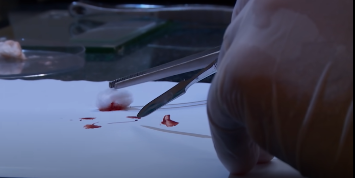 Dấu máu lập tức được đưa đi giám định, giải trình tự gien. Triệu tập toàn bộ các đối tượng hình sự, nghiện ma túy, bất minh về kinh tế và thời gian, Ban chuyên án thanh loại, lọc được 6 đối tượng có nhiều nghi vấn và bí mật theo dõi.