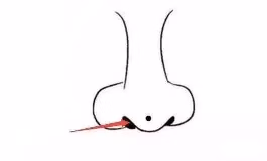 5 not ruoi may man nhat tren mat! Nhin xem ban co bao nhieu cai?-Hinh-4