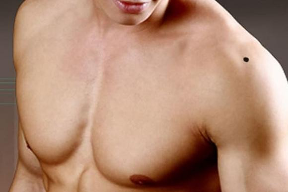 Nhung not ruoi xau tren co the dan ong canh bao so menh vat va, trac tro