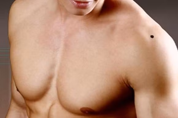 Nhung not ruoi xau tren co the dan ong canh bao so menh vat va, trac tro