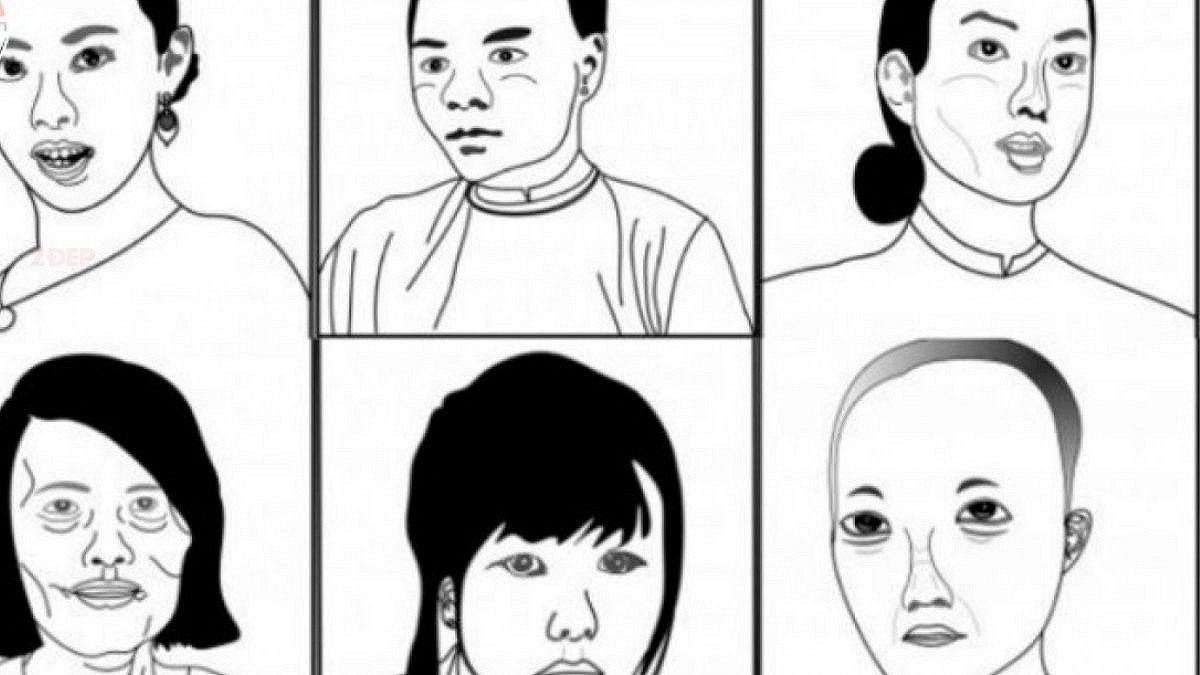 Trong nghiên cứu của nhiều học giả vĩ đại cũng đề cập rằng: Những người có ngoại hình như vậy nói chung là cay đắng và khắc nghiệt, khiến mọi người cảm thấy khó chịu. Vào thời cổ đại, năng suất kém và điều kiện sống của người dân không được tốt lắm. Những người béo tốt thường được coi là may mắn “béo và phước”.