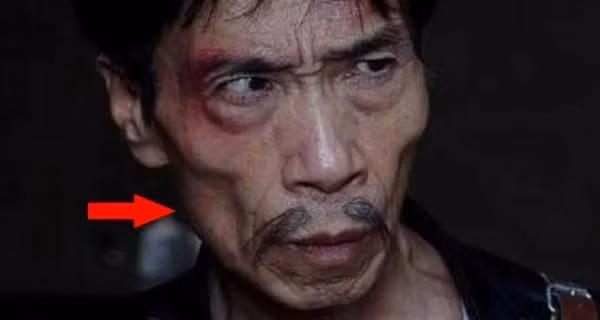 Việc thiếu thịt ở hai má cũng là một khuôn mặt xấu trong sinh lý học. Việc không có thịt ở hai má cho thấy người đó có điều kiện sống kém và không đủ dinh dưỡng, vì vậy những người ở trạng thái này có thể thích tham lam và rẻ tiền. Nếu bạn phải đối mặt với lợi ích, anh ta có thể không tử tế, vì sở thích phản bội bạn bè, đó là lý do tại sao nói không phù hợp để làm bạn.