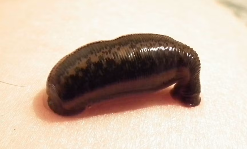 Nghề bắt đỉa khá phổ biến tại Pháp năm 1885.