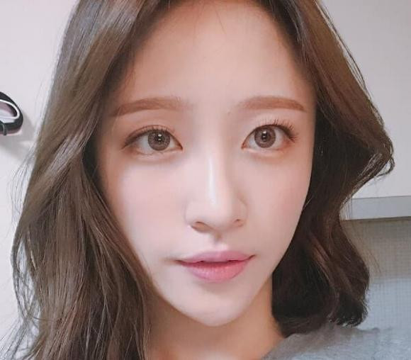 Nguoi so huu tuong mat nay it loc bam sinh, cuoc song kho khan vat va, de bi hao tai ton cua-Hinh-2