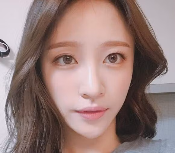 Nguoi so huu tuong mat nay it loc bam sinh, cuoc song kho khan vat va, de bi hao tai ton cua-Hinh-2