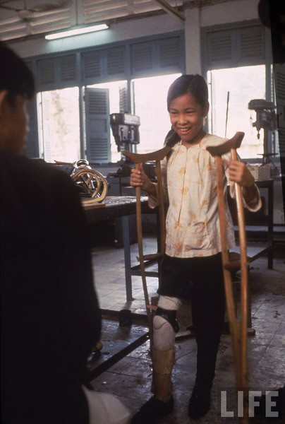 Lính Mỹ nhanh chóng đổ bộ xuống hiện trường và phát hiện ra rằng nạn nhân của họ là một ông già và hai bé gái. Họ đưa Tròn lên máy bay trực thăng và chở về bệnh viện ở Củ Chi. Ảnh: Tròn nhận chiếc chân giả của mình.