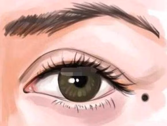 Nguoi co not ruoi o day ca doi se co vo so dao hoa