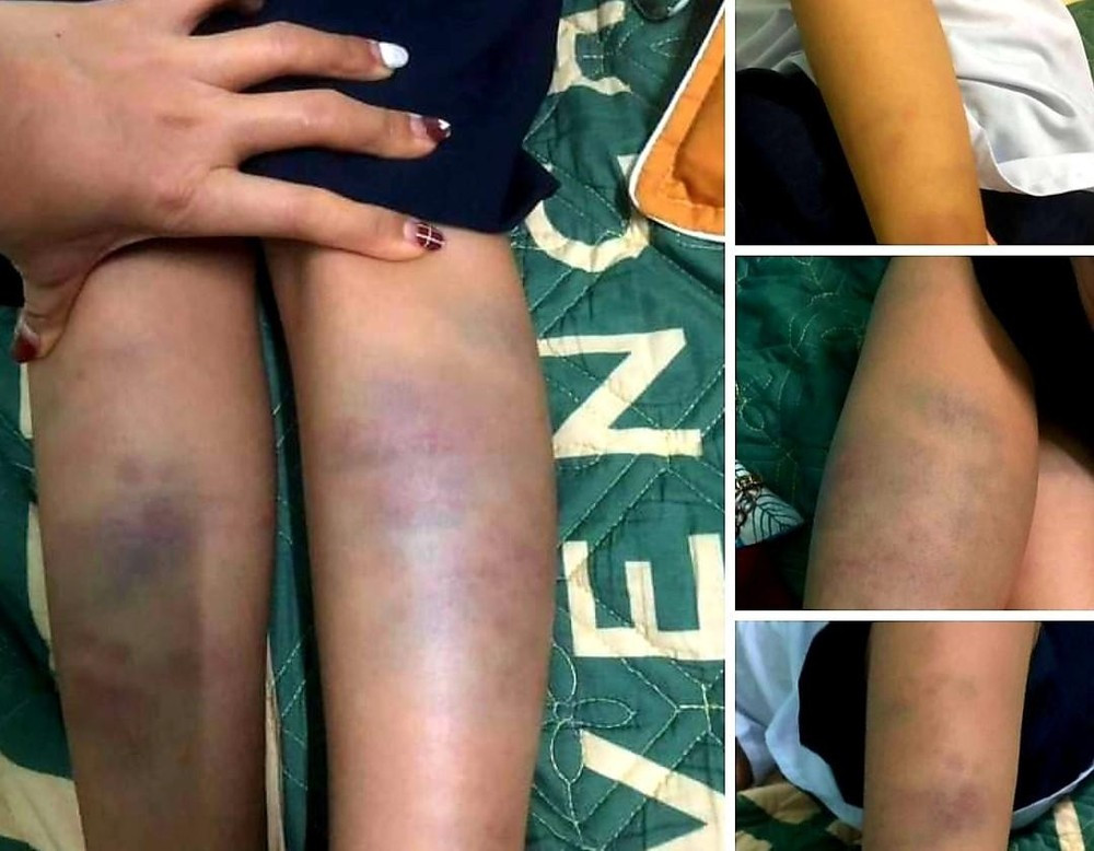 Cong an vao cuoc vu hoc sinh bi danh bam tim o truong