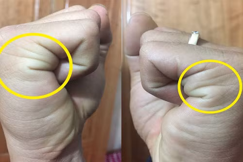 Có 2 đường chỉ. Người có 2 đường chỉ khi nắm bàn tay rất siêng năng, chăm chỉ. Họ thân thiện, khéo ăn nói nên dễ thích nghi với môi trường mới và được mọi người yêu quý.