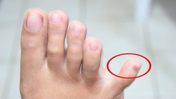 Nhìn vào điểm này là biết ngay thận khỏe hay không Nhin vao diem nay la biet ngay than khoe hay khong