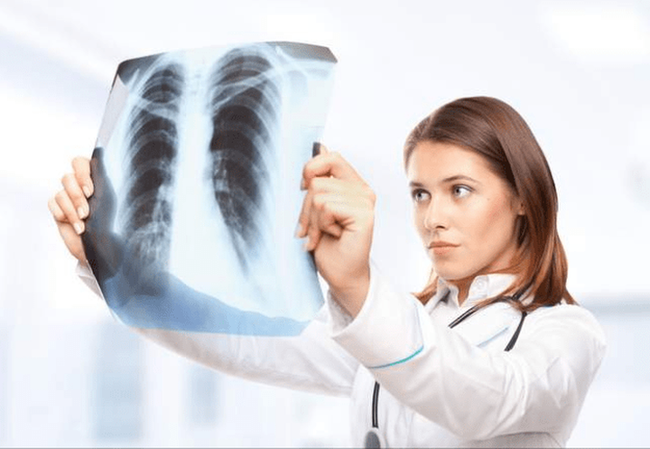 Chang trai khong hut thuoc, phoi nhu “luoi danh ca”... thu pham nam tren tuong-Hinh-3