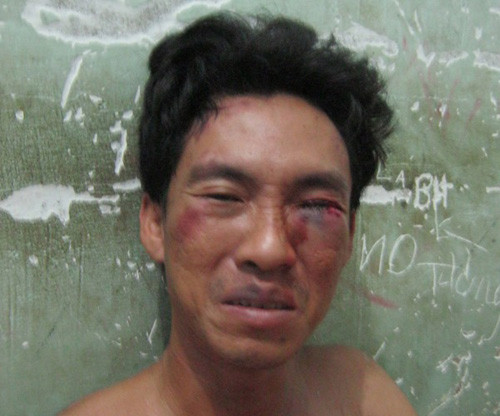 Hung thủ Nguyễn Minh Tú