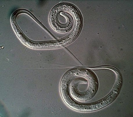 Một loại giun tròn khác có tên là Guinea thậm chí còn kinh khủng hơn giun đũa bởi có thể phát triển tới kích thước một mét.