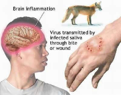 Bệnh dại. Bệnh từng là nỗi kinh hoàng của nhiều quốc gia trong đó có Việt Nam. Bệnh dại chủ yếu lây qua các vết cắn của động vật có vú. Bệnh dại được ngăn ngừa bằng cách tiêm chủng, có hiệu quả với cả trường hợp mới bị lây nhiễm. Mặc dù bệnh dại rất khó kiểm soát trong thế giới hoang dã những nó đã bị triệt tiêu trên các loài chó ở Mỹ.