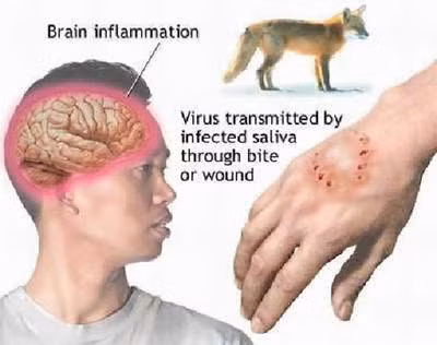 Bệnh dại. Bệnh từng là nỗi kinh hoàng của nhiều quốc gia trong đó có Việt Nam. Bệnh dại chủ yếu lây qua các vết cắn của động vật có vú. Bệnh dại được ngăn ngừa bằng cách tiêm chủng, có hiệu quả với cả trường hợp mới bị lây nhiễm. Mặc dù bệnh dại rất khó kiểm soát trong thế giới hoang dã những nó đã bị triệt tiêu trên các loài chó ở Mỹ.