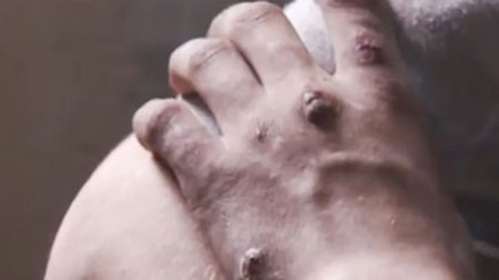 Hiện các nhà chức trách châu Âu đã chính thức lên tiếng cảnh báo về việc sử dụng loại ma tuý này, rất có thể nó sẽ trở thành đại dịch toàn cầu nếu không có biện pháp ngăn chặn kịp thời.